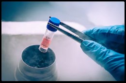 stem cells in a vial