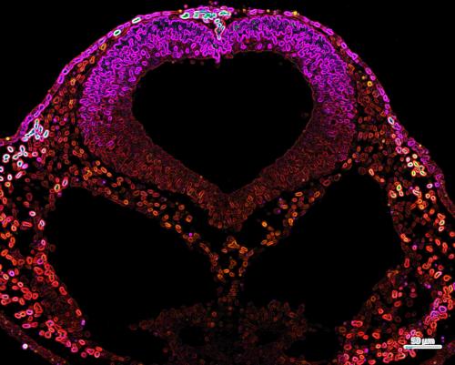 Cross section of a chicken embryo stained for migrating neural crest cells and embryonic brain.