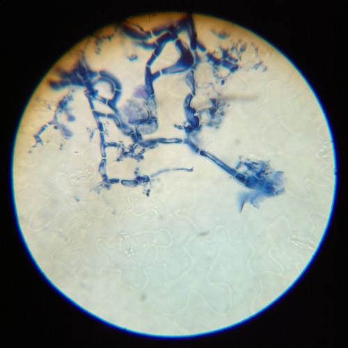 Microscope image of grey mold entering a leaf.