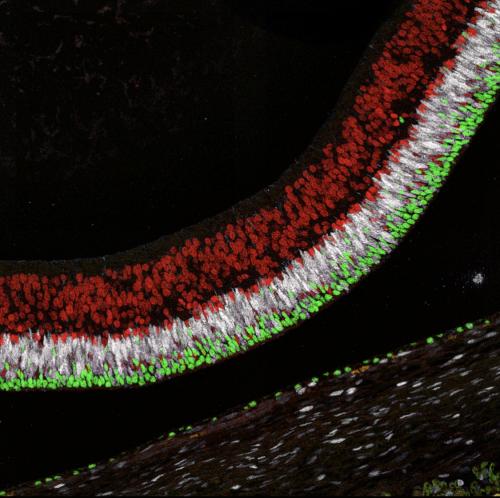 Confocal microscopy image of a retina stained for photoreceptors (green), progenitor cells (white) and retina ganglion cells (red).