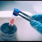 stem cells in a vial